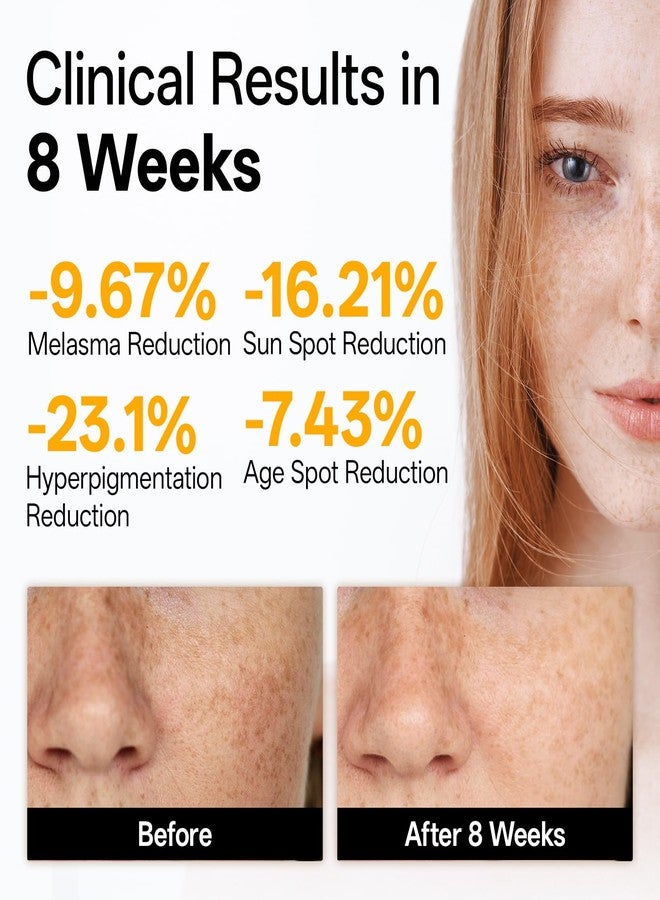 WNP Vitamin C Serum for Face - Dermatologist Tested Anti-Aging & Brightening with Hyaluronic Acid & Vitamin E, Treatment for Dark, Age, Sun Spot, Melasma, Hyperpigmentation, Fine Lines & Wrinkles - Image 2